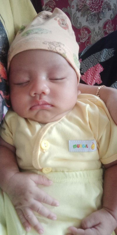 Baby sakit mata