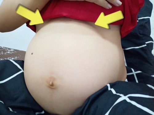มีอาการชาๆตรงลูกศร