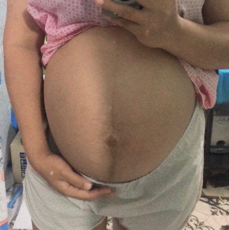 40week1day