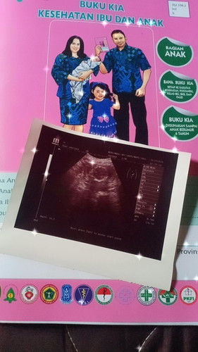 Hello Bun Kehamilan 4 bulan apa udh ngerasain gerak dedek utun nya gak Bun bisa lihat JK nya di usg