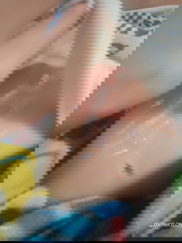 Napaso si baby ng mainit na tubig