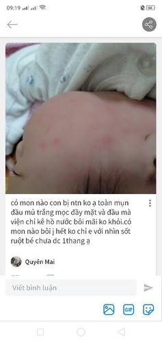 Con m nào bị ntn ko ạ có thuốc j bôi cho bé ko ạ hay tắm j cho hết ko chỉ e với