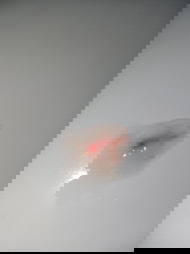 Keputihan + Darah on week 9