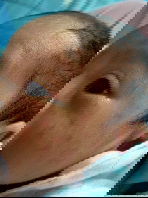 ผื่นแบบนี้เรียกว่าอะไรคะ