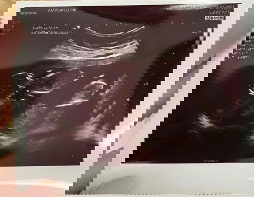 แม่ๆบ้านไหนได้แฝดชายบ้างคะ