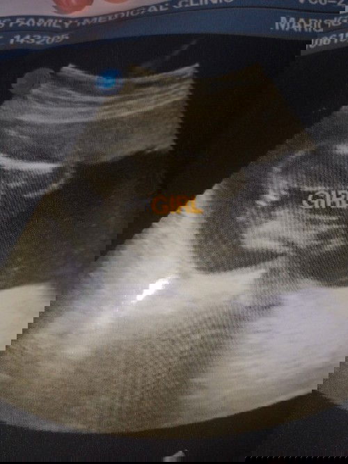 Baby girl 4th pregnancy.
# rainbow baby