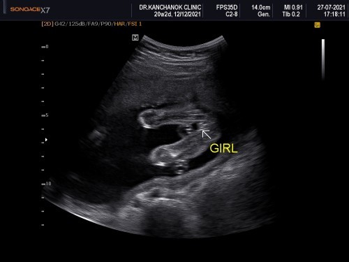 ขอประสบการณ์คุณแม่ๆหน่อยค่า🥰