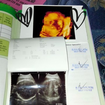 Bund mau tanya nih,,, saya sudah hamil 34week, tp payudara belum keluar cairan ,, normal gk itu ya??