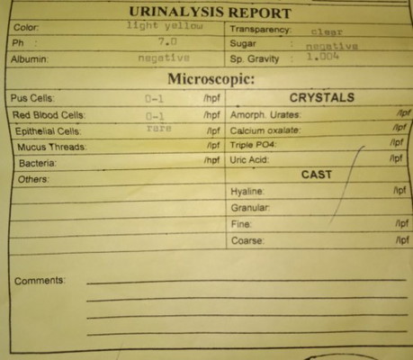 URINALYSIS