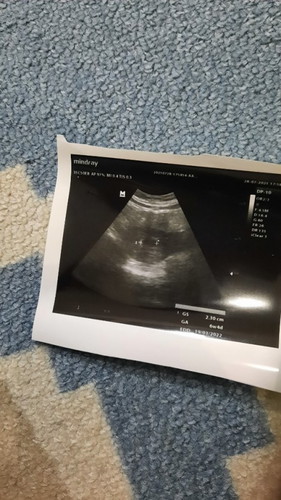 Minum susu hamil pas hamil 6 bulan, boleh gak ya? Merk rekomendasi dong yg enak.. aku suka coklat.