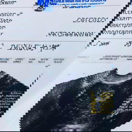 ตัวเล็กของแม่