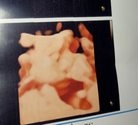 Mấy mom cho em hỏi baby nhà em 22W mà đc 421g vậy có bé quá ko ạ-