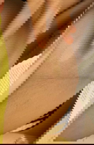 ท้องบวมแดง อายุครรภ์ 37+1 ปกติไหมคะ