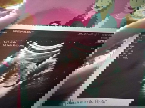 ขอสอบถามทีค่ะ