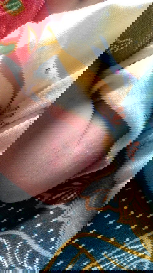 Ruam di lipetan badan bayi.