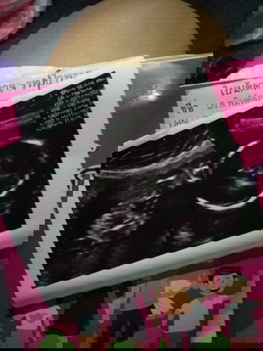 อายุ38 มีลูกสาว 3 คนคะ รอบนี้ท้องที่4 ได้ผู้ชายสมใจแล้วคะ .. มีใคร!!ลูกสาวดกเหมือนกันไหมคะ☺☺☺