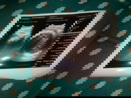 Hpl 12 September 2021