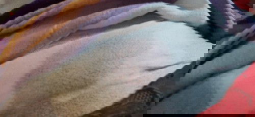 Jaitan pasca sc pendarahan