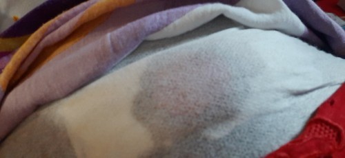 Jaitan pasca sc pendarahan