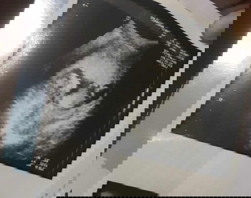 ท้องเล็กคุณแม่ท้องแรก