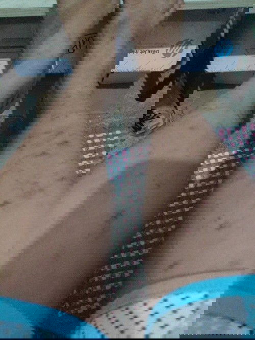 Scars during pregnancy