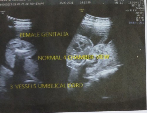 ตั้งท้อง21Weekค่ะ คุณลุงหมอบอกว่าผญ. แม่ๆดูกันออกมั้ยคะ