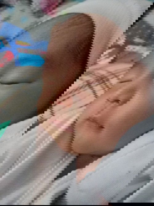 Ask ko lang po db hndi po ng aaaraw.. pano po kaya un medyo naninilaw kasi face ng baby ko..