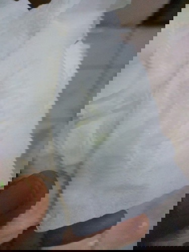 ตกขาวสีนี้ปกติไหมคะ