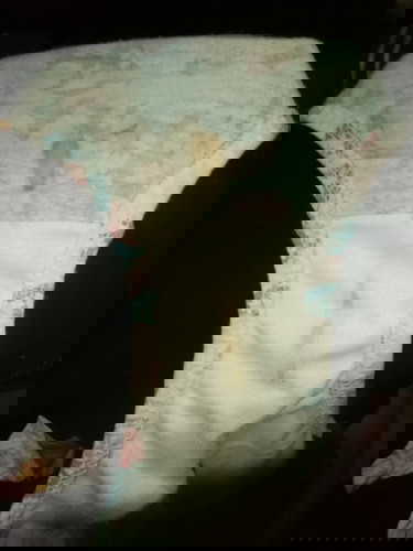 12 weeks pregnant.. normal po na ganitong discharge? tanung lng po salamat sa sasagot🙏