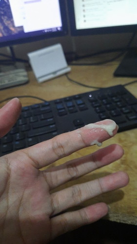 White discharges habang 26weeks pregnant