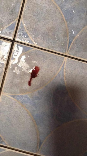 เลือดออกค่ะ ต้องไปหาหมอด่วนมั้ย