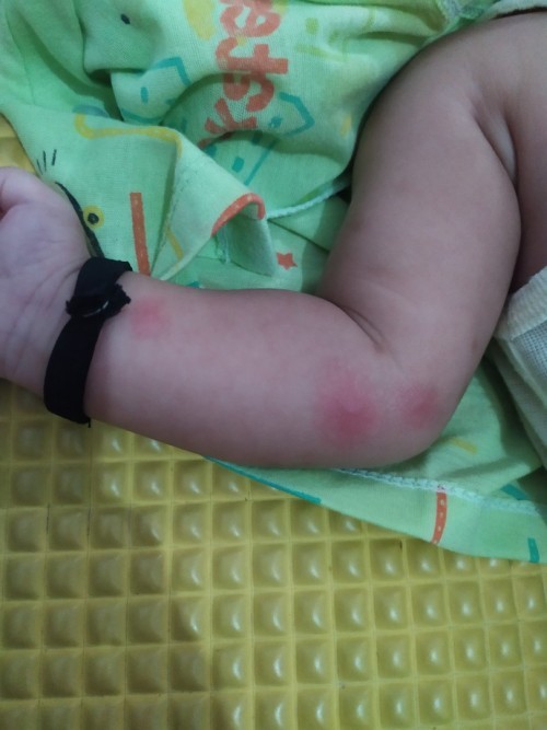 Bentol2 merah
