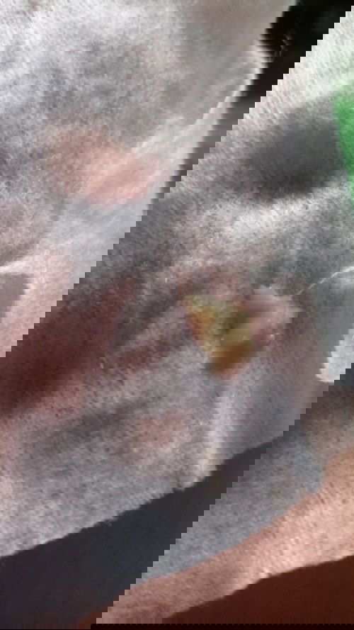 Bunda bunda akeluarvcairan seperti ingus dari telinga kanan.