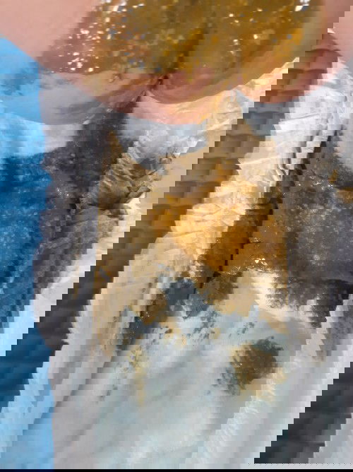 Poop ni baby, Normal lang po ba yung ganito poop ni baby?