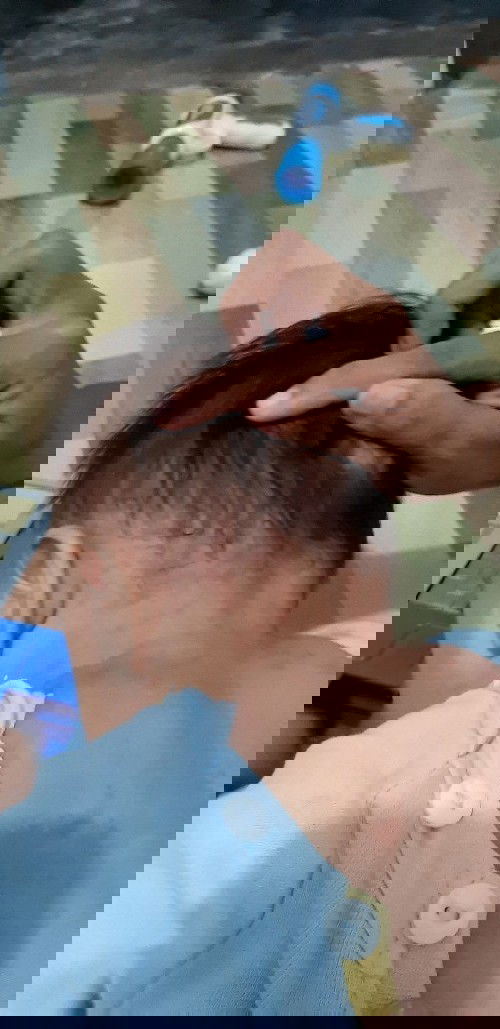 Ruam seperti biang keringat