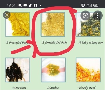 Seputar susu formula