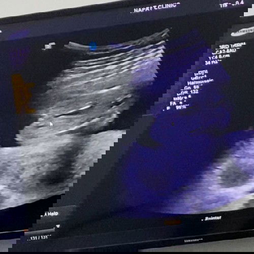 ผู้หญิง หรือ ผู้ชายคะแบบนี้?