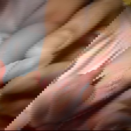 Ano po tawag at pwedeng igamot po dto 2 mos
old baby po nababad po sa laway dhil sa thumbsucking ty