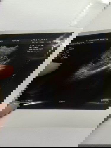 น้องตัวเล็กไปไหมคะ