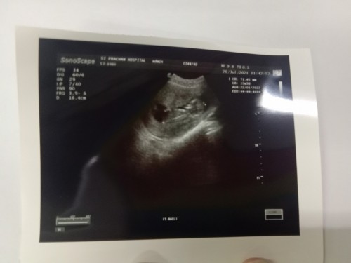 อายุเยอะกังวลมากๆคะ