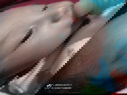 Bintik putih pipi bayi