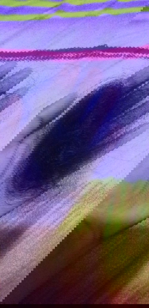 Rambut Rontok sehabis melahirkan