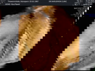 29w4d น้ำหนักเท่าไรกันแล้วค่ะ