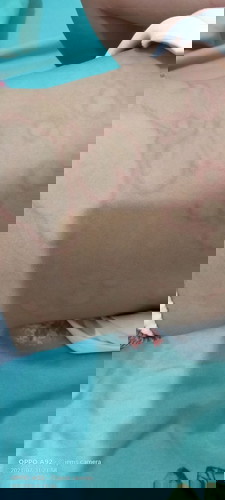 skin problem