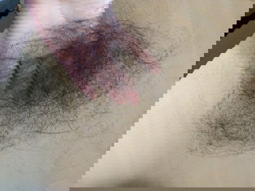 solusi rambut rontok versi sederhana