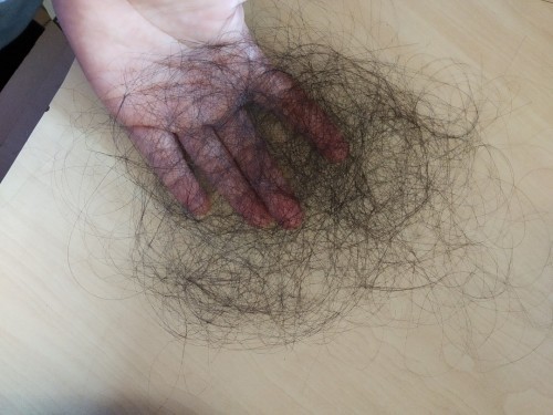 solusi rambut rontok versi sederhana