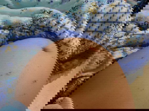 ท้องลายทำไงดี