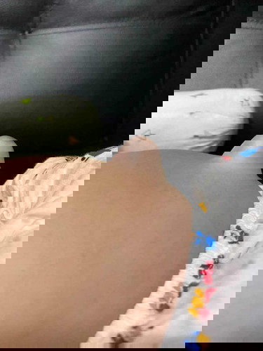 สะดือจุ่น อันตรายไหมคะ