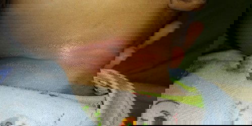 Merah dan bintik dileher bayi