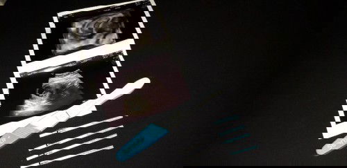 USG 8w2d, ada ywbg sama bund ?